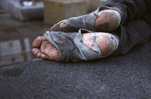 Homeless feet