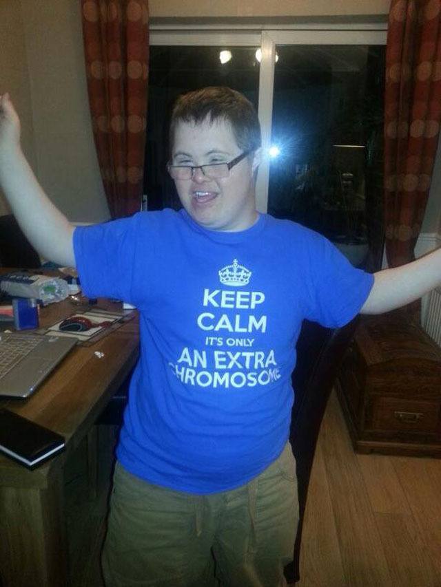 best-viral-pictures-extra-chromosome