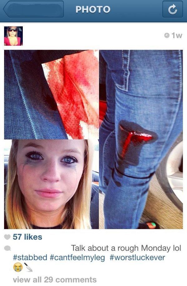 best-viral-pictures-instagram-injury