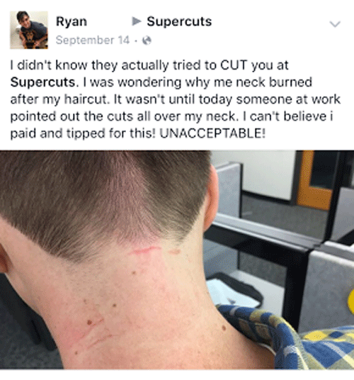 Neck Burned Haircut Disaster