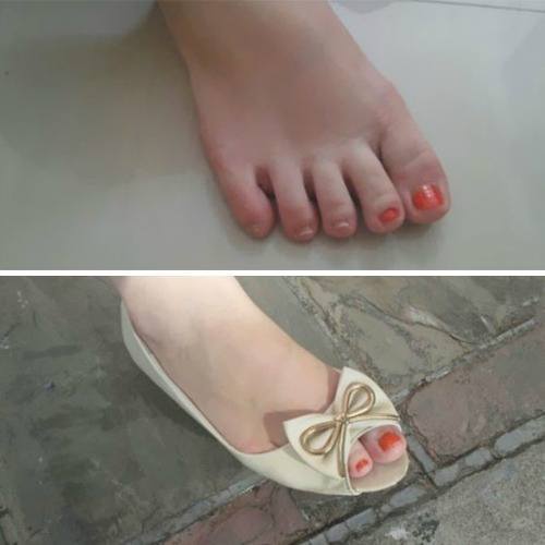 Toenails