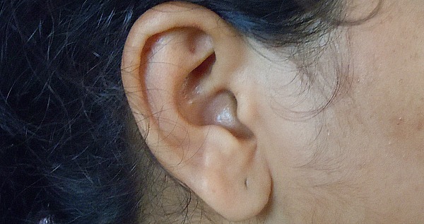 Right Ear